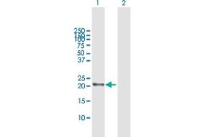Western Blot analysis of RGS5 expression in transfected 293T cell line by RGS5 MaxPab polyclonal antibody. (RGS5 Antikörper  (AA 1-181))