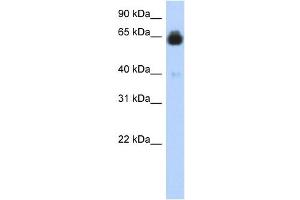 IGFALS antibody used at 1 ug/ml to detect target protein.
