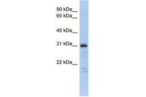 Image no. 1 for anti-Homeobox D9 (HOXD9) (AA 143-192) antibody (ABIN6742472) (HOXD9 Antikörper  (AA 143-192))