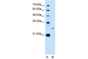 Tetraspanin 15 antibody used at 1 ug/ml to detect target protein. (Tetraspanin 15 Antikörper  (C-Term))