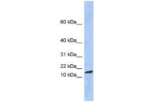 WB Suggested Anti-TAL2 Antibody Titration:  0. (TAL2 Antikörper  (Middle Region))