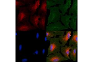 ABIN6264142 and ABIN6266623 staining  cells by IF/ICC. (Peripherin Antikörper  (C-Term))