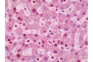 Anti-CIDEA / CIDE-A antibody IHC staining of human liver. (CIDEA Antikörper  (AA 181-209))