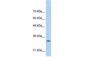 WB Suggested Anti-MAFB Antibody Titration:  0. (MAFB Antikörper  (N-Term))