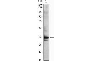 Western blot analysis using CDC2 mouse mAb against Jurkat (1) cell lysate. (CDK1 Antikörper)