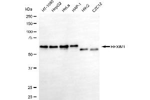 Western blotting analysis using HEXIM1 antibody (ABIN7798905). (HEXIM1 Antikörper)