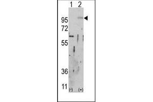 Western blot analysis of FGFR2 (arrow) using rabbit polyclonal FGFR2 Antibody. (FGFR2 Antikörper)