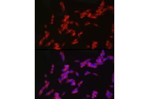 Immunofluorescence analysis of SH-SY5Y cells using nNOS Rabbit mAb (ABIN1680436, ABIN1680435, ABIN7101483 and ABIN7101484) at dilution of 1:100 (40x lens). (NOS1 Antikörper)