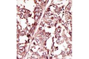 Image no. 2 for anti-C-Ros Oncogene 1 , Receptor tyrosine Kinase (ROS1) (AA 33-63), (N-Term) antibody (ABIN359936) (ROS1 Antikörper  (N-Term))