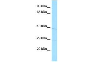 Western Blotting (WB) image for anti-Wingless-Type MMTV Integration Site Family, Member 11 (WNT11) (Middle Region) antibody (ABIN2776712)