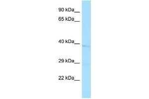 Host:  Rabbit  Target Name:  Wnt11  Sample Type:  Mouse Stomach lysates  Antibody Dilution:  1. (WNT11 Antikörper  (Middle Region))