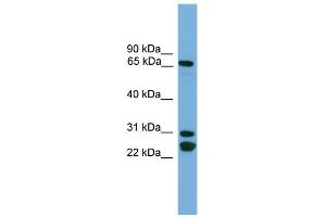 WB Suggested Anti-DNAI2 Antibody Titration:  0. (DNAI2 Antikörper  (N-Term))