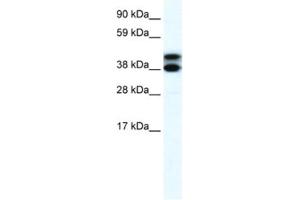 Western Blotting (WB) image for anti-Tripartite Motif Containing 13 (TRIM13) antibody (ABIN2460875) (TRIM13 Antikörper)