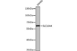 Western blot analysis of extracts of SW480 cells, using SLC16 Rabbit pAb (ABIN7270403) at 1:1000 dilution. (SLC16A4 Antikörper  (AA 250-350))