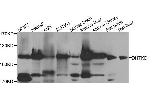 Western blot analysis of extracts of various cell lines, using DHTKD1 antibody (ABIN5974840) at 1/1000 dilution. (DHTKD1 Antikörper)