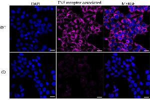 Immunocytochemical staining of HeLa cells using TNF receptor associated protein 1 antibody (ABIN7800567), 1:1,000), Top panel: wild-type (WT), Bottom panal: TNF receptor associated protein 1 shRNA knockdown (KD). (Rekombinanter TRAP1 Antikörper)
