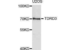 Western blot analysis of extracts of U2OS cells, using TDRD3 antibody (ABIN5973573) at 1/1000 dilution. (TDRD3 Antikörper)