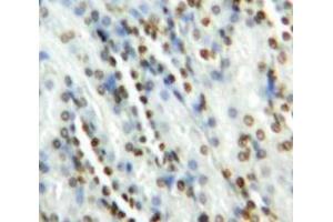 IHC-P analysis of Kidney tissue, with DAB staining. (GATA2 Antikörper  (AA 175-480))