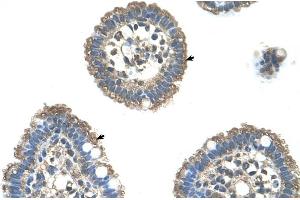 Human Intestine (UBE2L3 Antikörper  (C-Term))