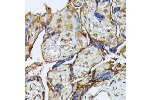 Immunohistochemistry (IHC) image for anti-Death-Associated Protein Kinase 3 (DAPK3) (AA 1-100) antibody (ABIN7266712)