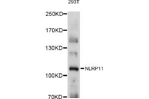 Western blot analysis of extracts of 293T cells, using NLRP11 antibody (ABIN6131484, ABIN6144660, ABIN6144661 and ABIN6215714) at 1:1000 dilution. (NLRP11 Antikörper  (AA 420-600))