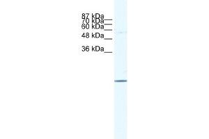WB Suggested Anti-E2F6 Antibody   Titration: 1.