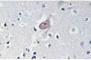 Immunohistochemistry analysis of p-Abl1/2 antibody (pTyr393/439) Cat. (ABL1 Antikörper  (pTyr393, pTyr439))