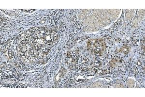 IHC analysis of LSM7 using anti-LSM7 antibody (ABIN7598937).