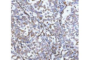 IHC analysis of Hsp47/SERPINH1 using anti-Hsp47/SERPINH1 antibody (ABIN3043331).