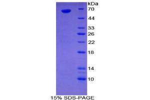 SDS-PAGE (SDS) image for Sulfatase 1 (SULF1) (AA 609-871) protein (His tag,GST tag) (ABIN1878221) (SULF1 Protein (AA 609-871) (His tag,GST tag))