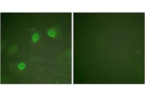 Immunofluorescence analysis of HeLa cells, using GATA3 antibody. (GATA3 Antikörper)