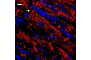 Immunohistochemistry (IHC) image for anti-Sodium Channel, Voltage-Gated, Type V, alpha Subunit (SCN5A) (AA 493-511), (Intracellular) antibody (ABIN7043650)