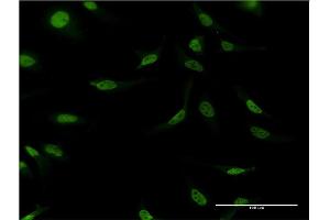 Immunofluorescence of monoclonal antibody to CSTF2 on HeLa cell.