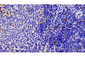 Detection of IBA1 in Rat Spleen Tissue using Polyclonal Antibody to Ionized Calcium-binding Adapter Molecule 1 (IBA1) (Iba1 Antikörper  (AA 1-147))