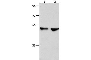 Western Blot analysis of 823 and Hela cell using CDK9 Polyclonal Antibody at dilution of 1:300