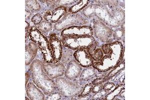 Immunohistochemical staining of human kidney with IL20RA polyclonal antibody  shows strong cytoplasmic positivity in renal tubules at 1:200-1:500 dilution. (IL20RA Antikörper)