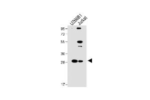 All lanes : Anti-LTM5 Antibody (N-term) at 1:1000 dilution Lane 1: U266B1 whole cell lysate Lane 2: Jurkat whole cell lysate Lysates/proteins at 20 μg per lane. (LAPTM5 Antikörper  (N-Term))
