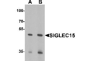Western blot analysis of SIGLEC15 in Rat kidney tissue lysate with SIGLEC15 antibody at (A) 1 and (B) 2 µg/mL