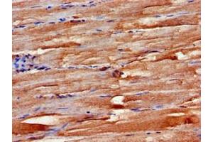 Immunohistochemistry of paraffin-embedded human skeletal muscle tissue using ABIN7152499 at dilution of 1:100 (FBXW2 Antikörper  (AA 72-340))