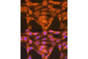 Immunofluorescence analysis of C6 cells using RA + RB Rabbit mAb (ABIN7269853) at dilution of 1:100 (40x lens). (RAP1A + RAP1B Antikörper)