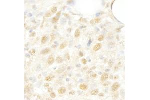 anti-LUC7-Like 3 (LUC7L3) (AA 1-50) antibody