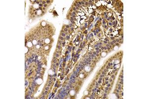 Immunohistochemistry of paraffin-embedded mouse ileum using CLASP1 antibody (ABIN5974258) at dilution of 1/100 (40x lens). (CLASP1 Antikörper)