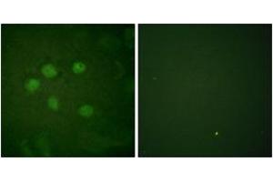 Immunofluorescence analysis of HuvEc cells, using AOS1 Antibody. (SAE1 Antikörper  (AA 221-270))