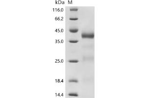 Cathepsin B (CTSB) (AA 18-339), (full length) protein (His tag)