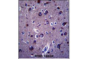 P Antibody (Center) 13689c immunohistochemistry analysis in formalin fixed and paraffin embedded human brain tissue followed by peroxidase conjugation of the secondary antibody and DAB staining. (APP Antikörper  (AA 333-362))