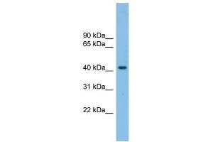 GPR87 antibody used at 1 ug/ml to detect target protein.