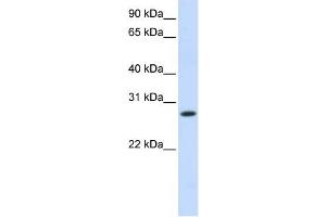 HSD11B1 antibody used at 1 ug/ml to detect target protein. (HSD11B1 Antikörper)