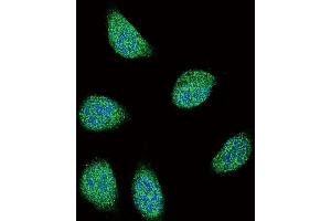 Confocal immunofluorescent analysis of SERPINA6 Antibody (Center) (ABIN654693 and ABIN2844385) with 293 cell followed by Alexa Fluor 488-conjugated goat anti-rabbit lgG (green).