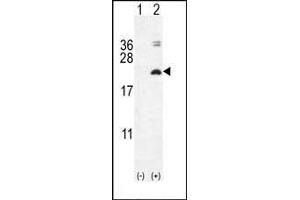 Western blot analysis of IL17F (arrow) using rabbit polyclonal IL17F Antibody (N-term) (ABIN654914 and ABIN2844560). (IL17F Antikörper  (N-Term))