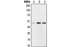 Western blot analysis of c-Jun expression in HEK293T (A), SP2/0 (B), H9C2 (C) whole cell lysates. (C-JUN Antikörper  (Center))